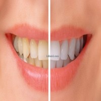 Where to find the best dentist Mumbai
