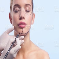 Chin Correction Surgery In Lucknow